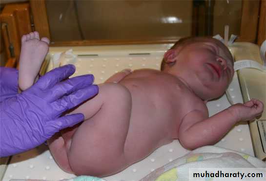 neonatal exam