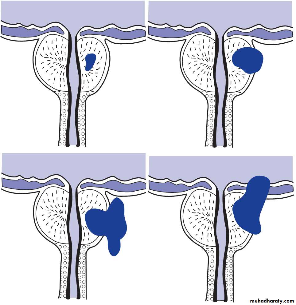 The Prostate and seminal vesicles 2