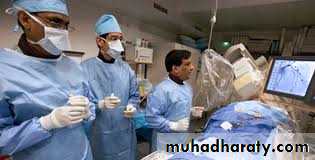 Diseases of the myocardium