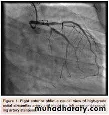 Diseases of the myocardium