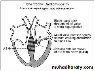 Diseases of the myocardium