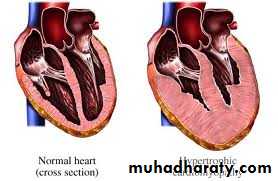 Diseases of the myocardium