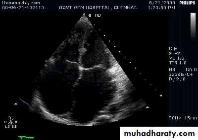 Diseases of the myocardium