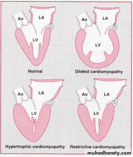 Diseases of the myocardium