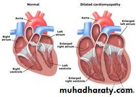 Diseases of the myocardium