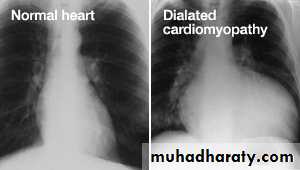 Diseases of the myocardium