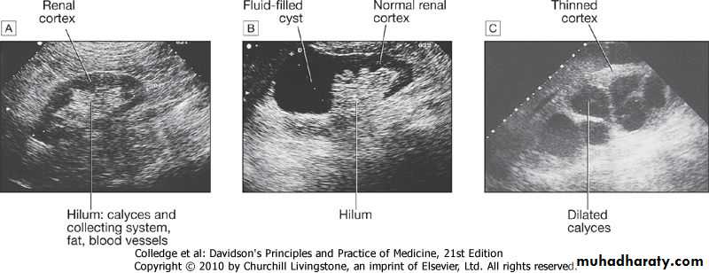 Investigations of Kidney and Urinary tract