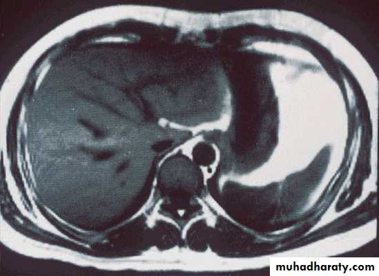 Investigations of Liver and Biliary tract 1