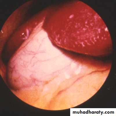 Investigations of Liver and Biliary tract 1
