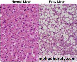 Patterns of hepatic injury