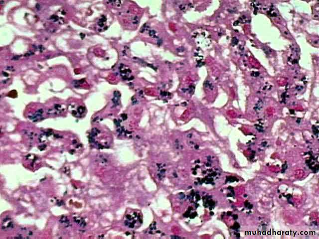 Patterns of hepatic injury