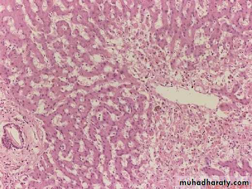 Patterns of hepatic injury
