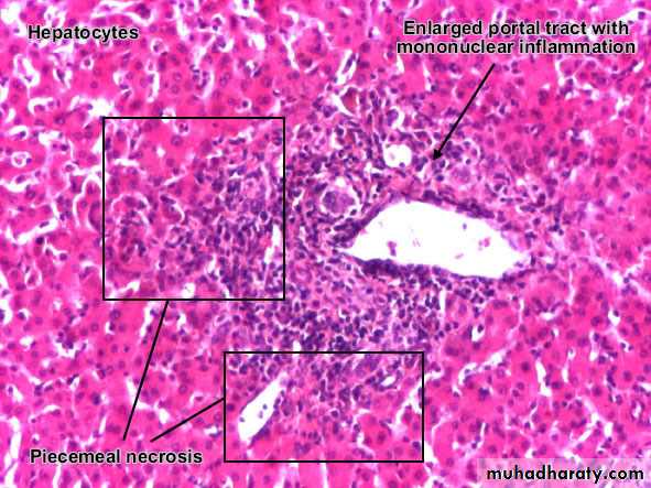 Patterns of hepatic injury
