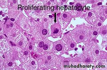 Patterns of hepatic injury
