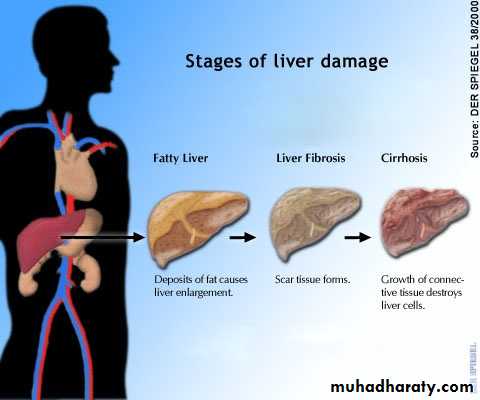 Patterns of hepatic injury