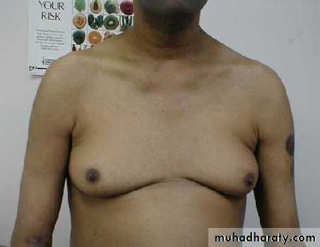 Acute liver failure