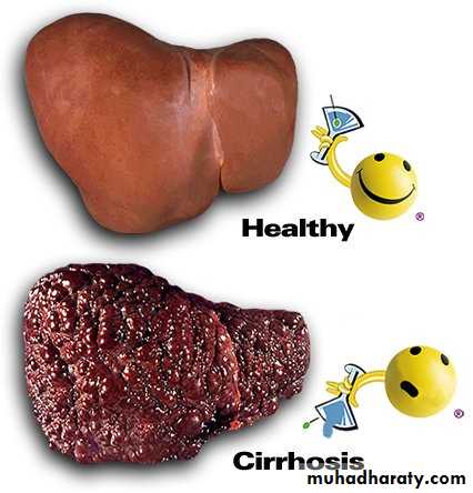 Alcoholic liver disease and Nonalcoholic fatty liver disease