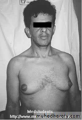 Alcoholic liver disease and Nonalcoholic fatty liver disease