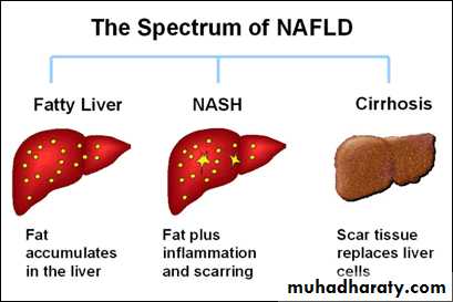 Alcoholic liver disease and Nonalcoholic fatty liver disease