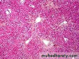 Primary biliary cirrhosis and Primary sclerosing cholangitis
