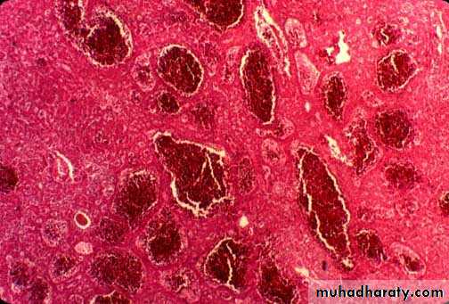 Primary biliary cirrhosis and Primary sclerosing cholangitis