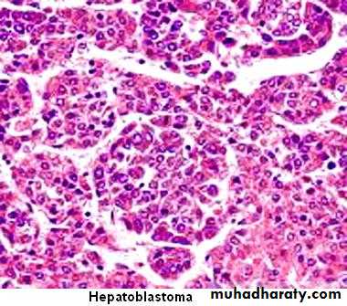Nodules and Tumors of the liver