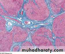 Nodules and Tumors of the liver