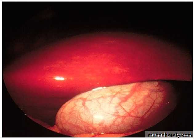 Pregnancy and the liver