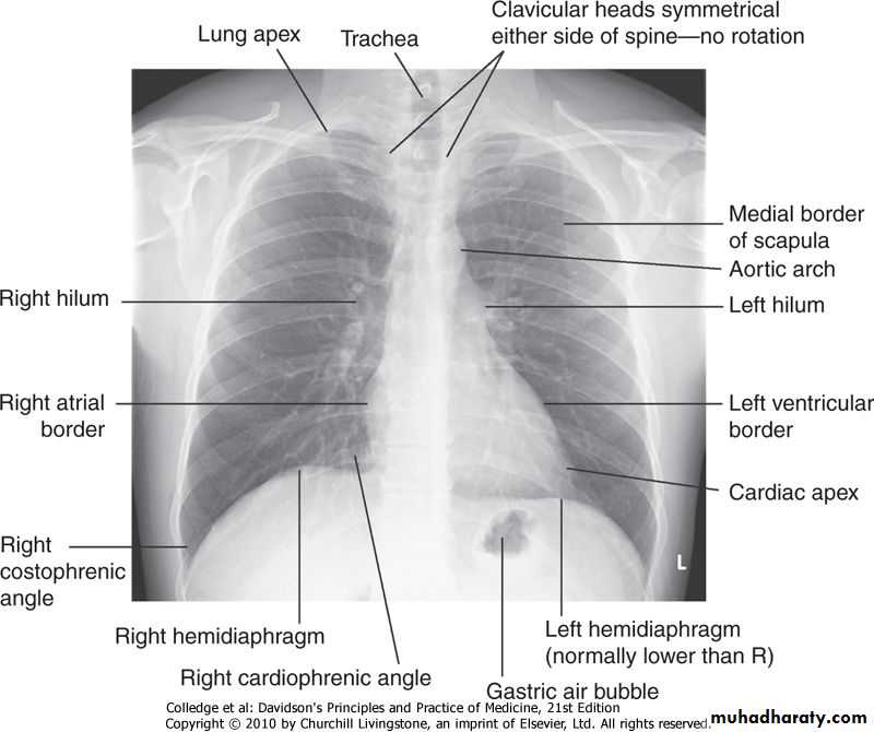 Investigations and presenting problems of the respiratory system