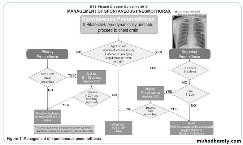 Pneumothorax