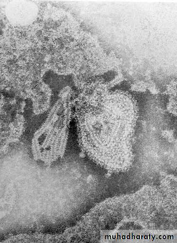 Mumps