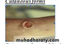 Leishmaniasis