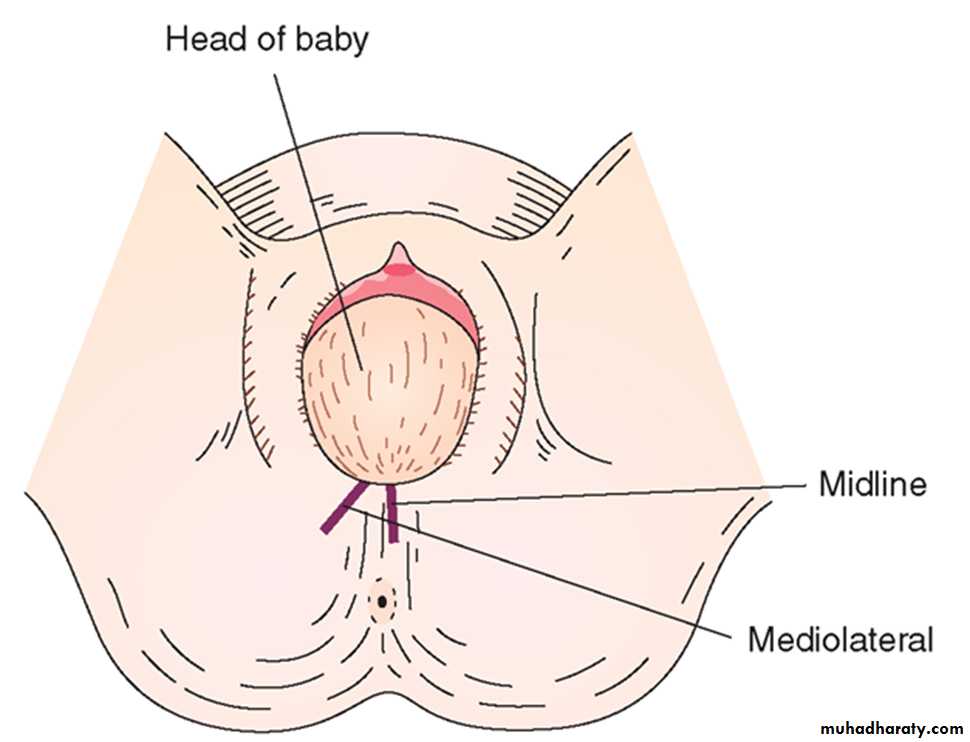 The process and mechanism of labour