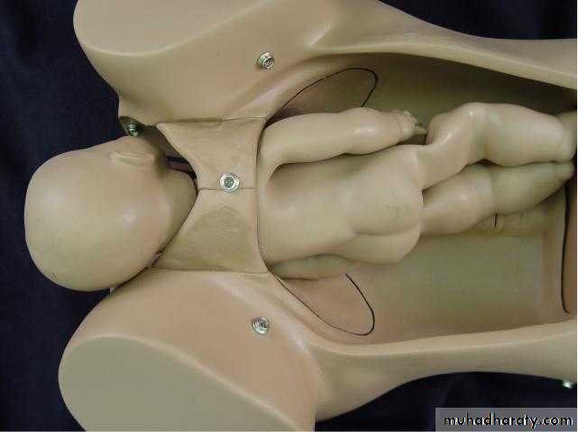 The process and mechanism of labour