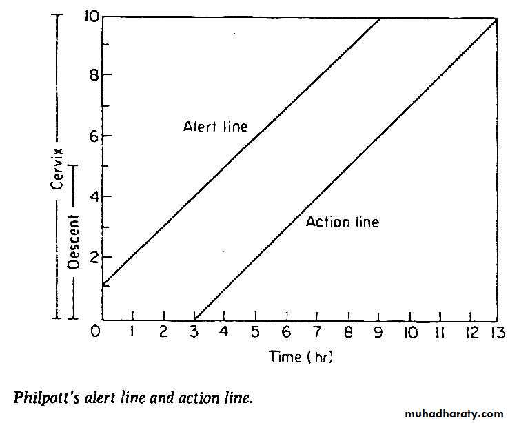The process and mechanism of labour