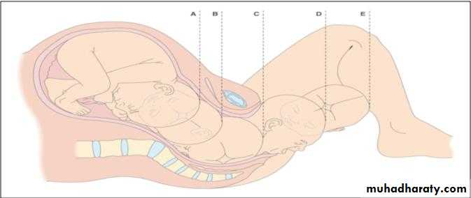 The process and mechanism of labour