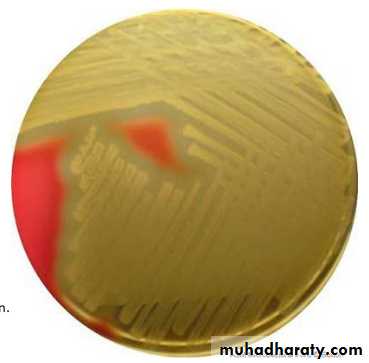 Streptococcus