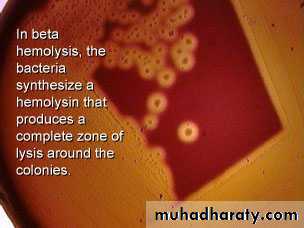 Streptococcus