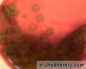Streptococcus