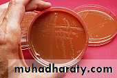 Streptococcus