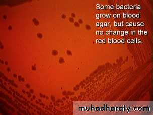 Streptococcus