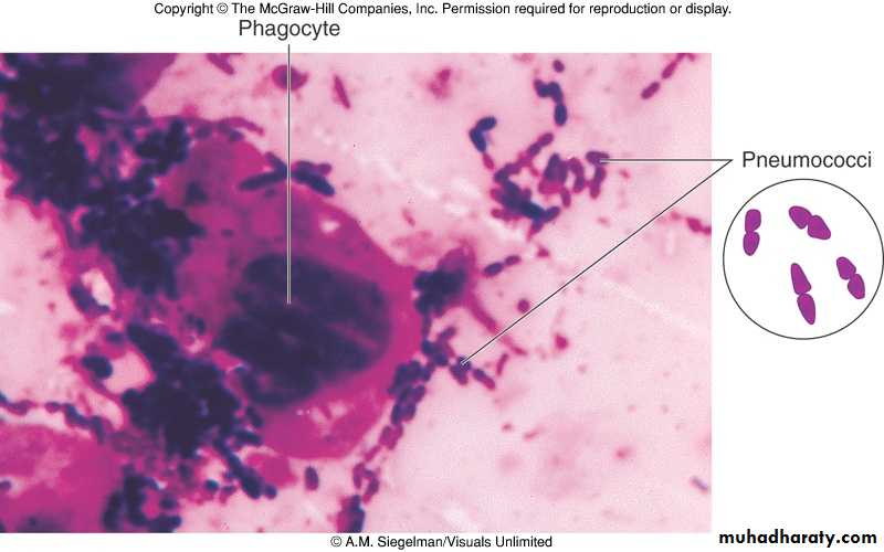 Streptococcus