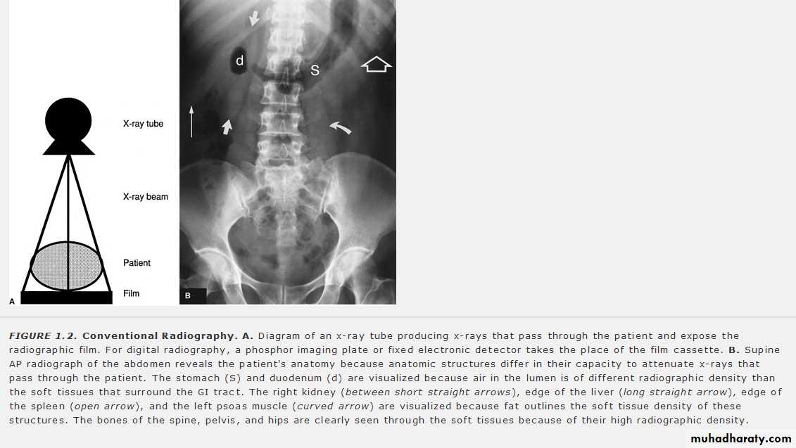 Introduction to Xray and CT