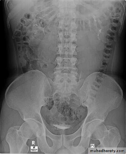 Urinary system