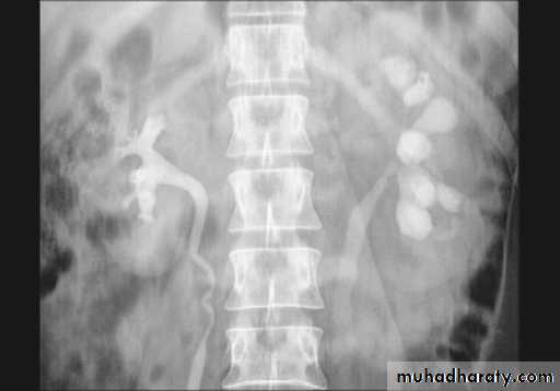 Urinary system