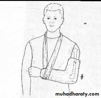 PRINCIPLE OF FRACTURES