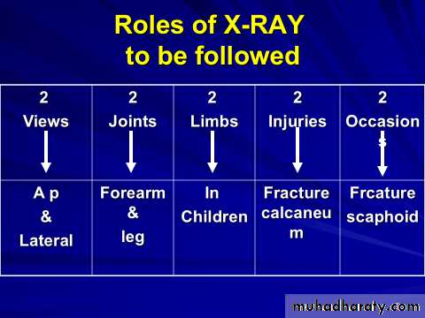 PRINCIPLE OF FRACTURES