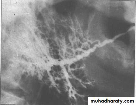 salivary glands