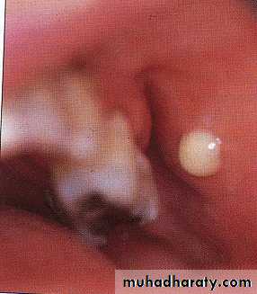 salivary glands