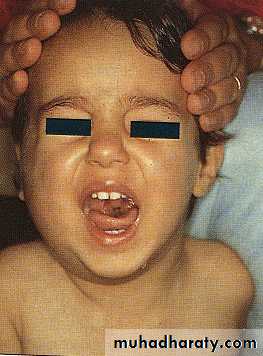 salivary glands